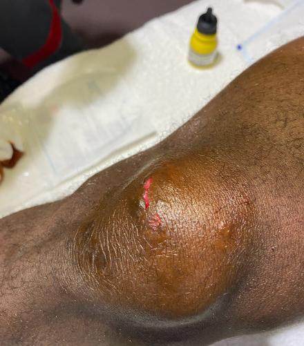 hth网页版-首红！赵宏略“废人式”飞踹巴索戈 中超新恶人诞生？